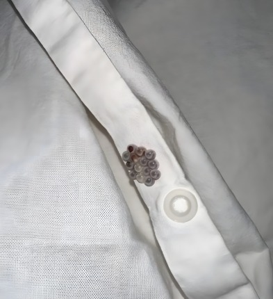 Ik vond deze kleine knikkers in mijn bed en kreeg bijna een hartaanval: Toen ik begreep wat het was, was ik erg bang. 😢 ik zal je vertellen wat het was.